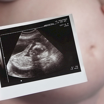 Pitäisikö raskaus tulkita sairaudeksi?